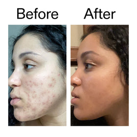 The INKEY List swatch before and after showing improved even skin tone