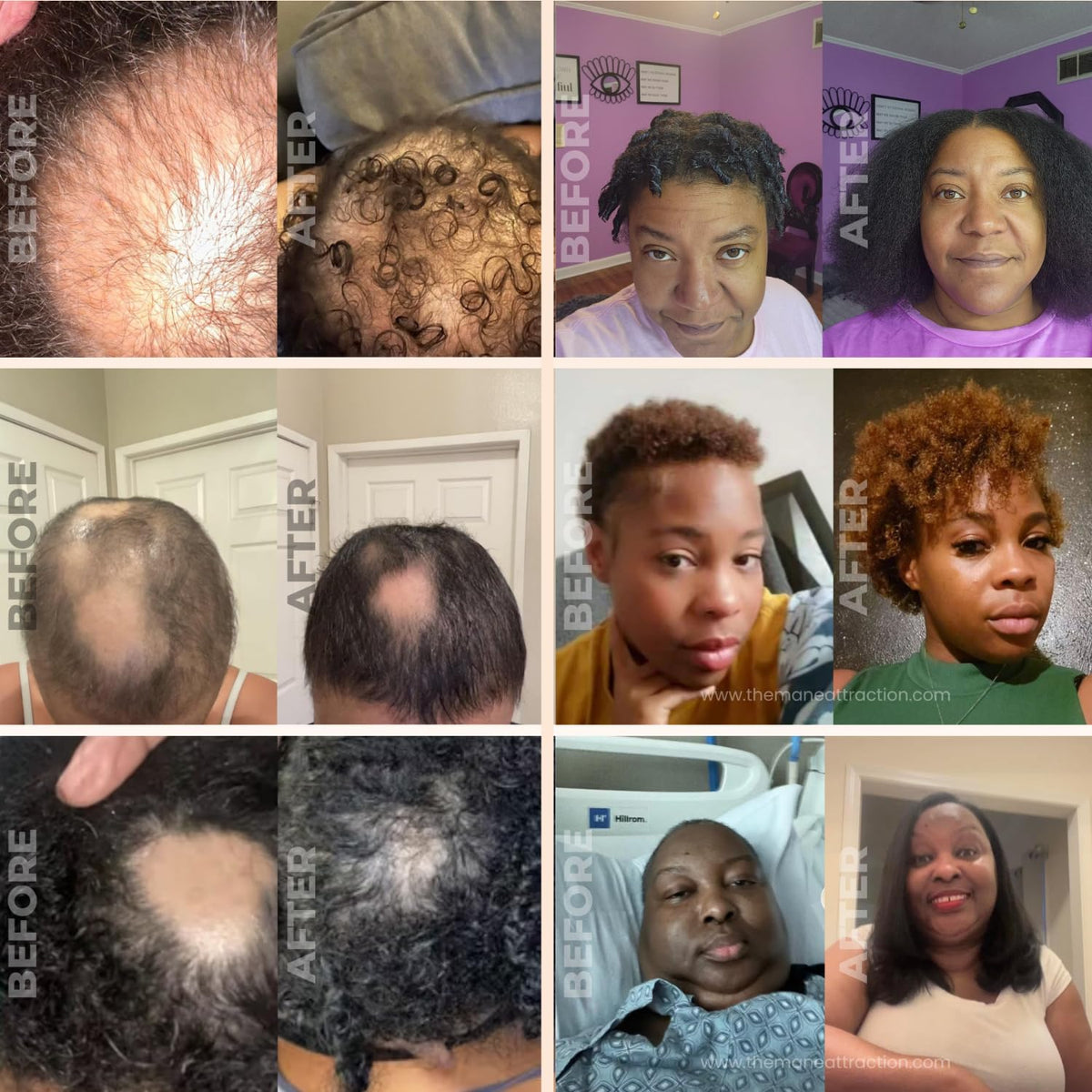 The Mane Attraction before and after length retention comparison