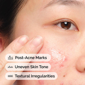Aloe leaf powder and capsules beside The Ordinary bottle highlighting key soothing ingredient