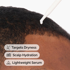 The Ordinary being massaged into scalp, showing targeted hydration and comfort benefit