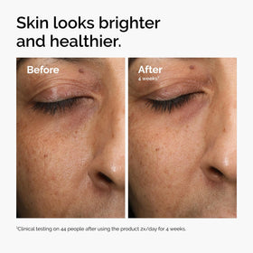 The Ordinary bottle label and ingredient panel showing active antioxidants and clarity