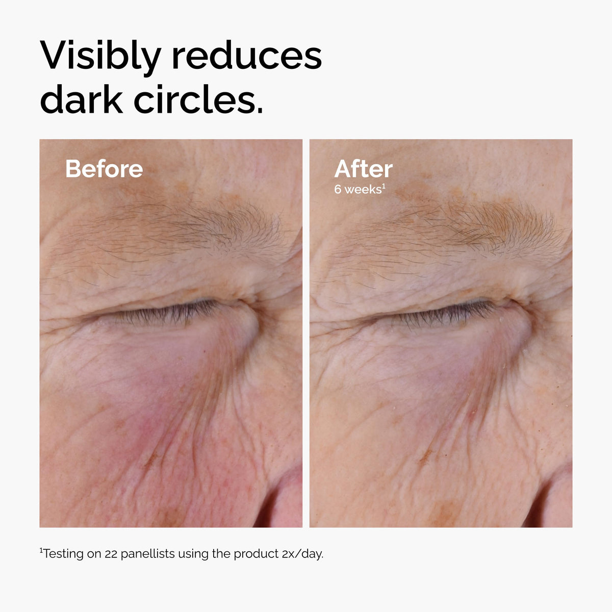 The Ordinary serum on hand droplet, illustrating small dose needed and easy control benefit