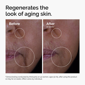 The Ordinary GF 15% Solution applied on hand demonstrating small drop usage and quick absorption