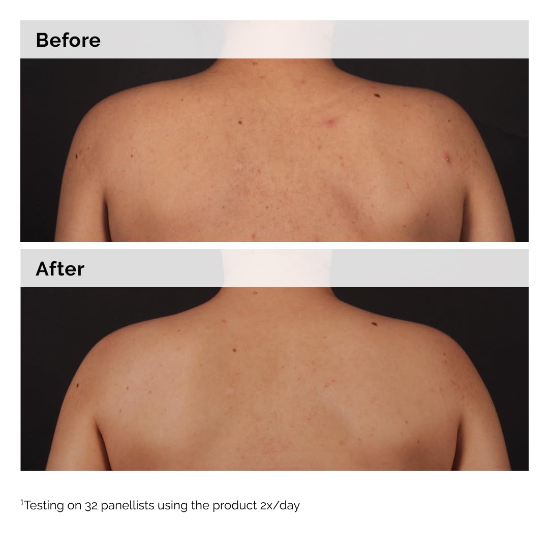 The Ordinary label and ingredients panel clarifying formulation transparency benefit