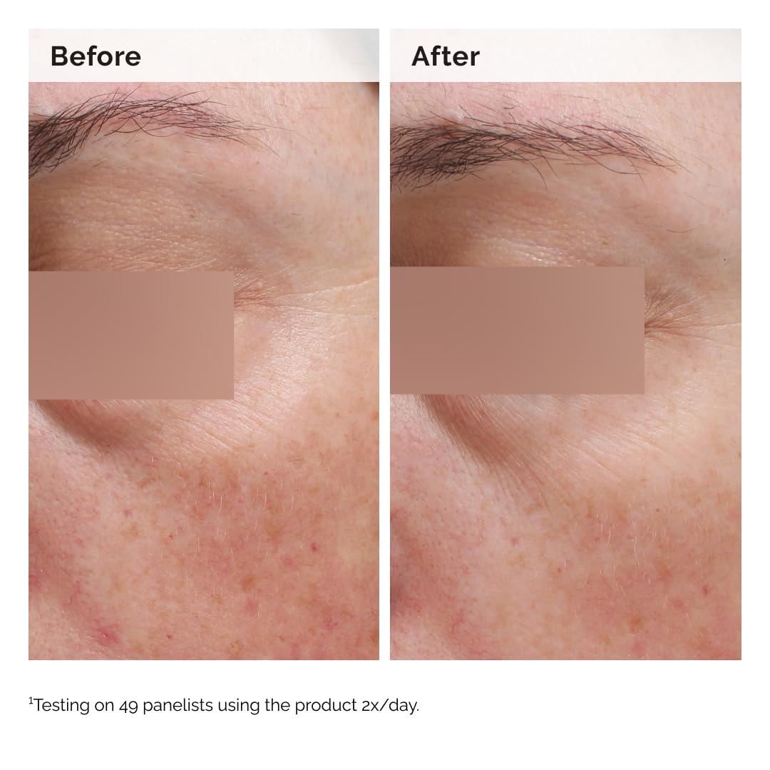 Label detail showing ingredients and 5% niacinamide, emphasizes concentration and formulation