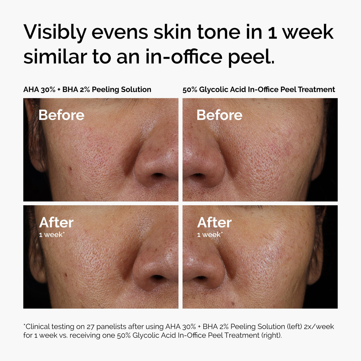 The Ordinary peel staged at bathroom sink suggesting home-use routine and convenience benefit