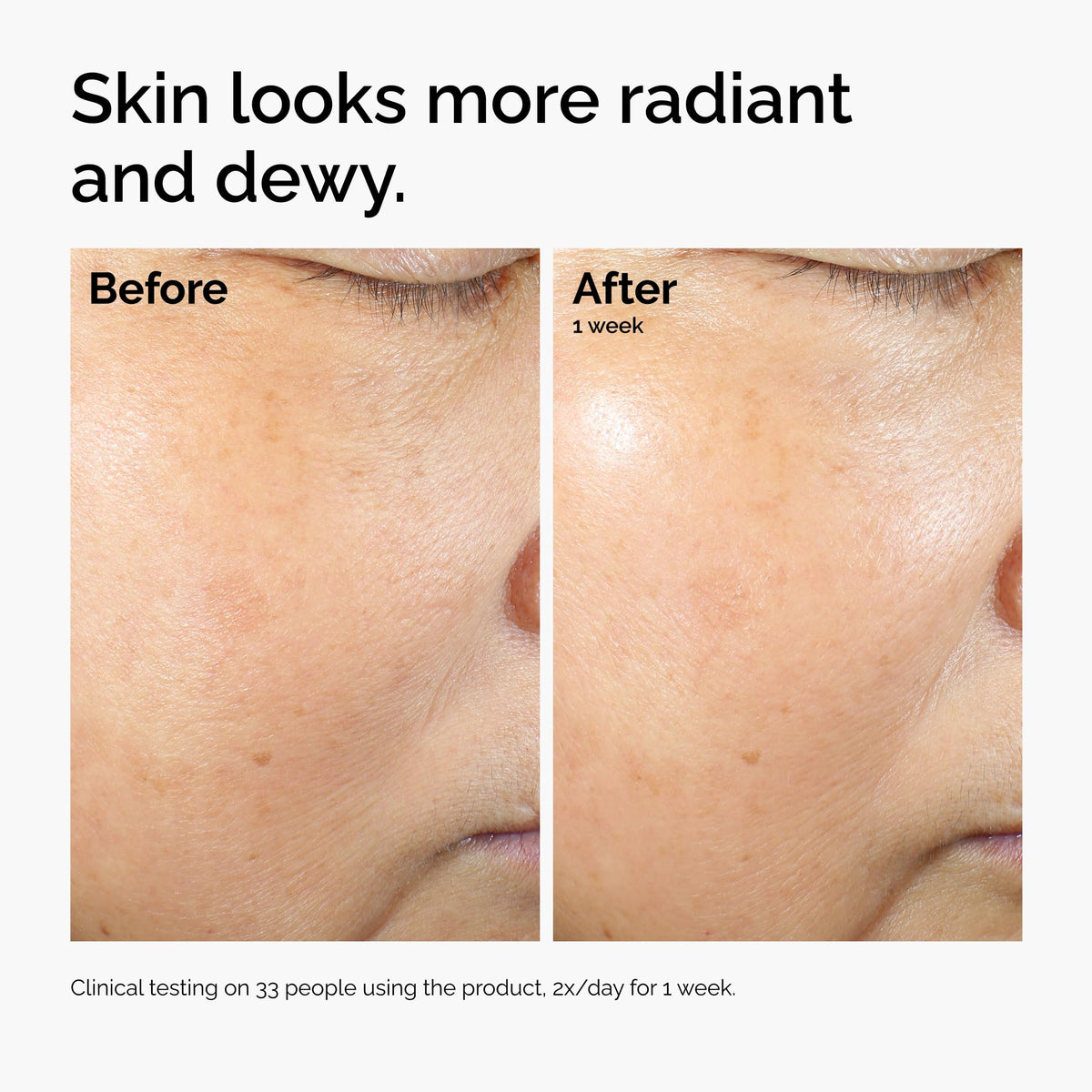 The Ordinary paired with Milky Toner showing boosted hydration results
