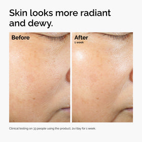 The Ordinary paired with Milky Toner showing boosted hydration results
