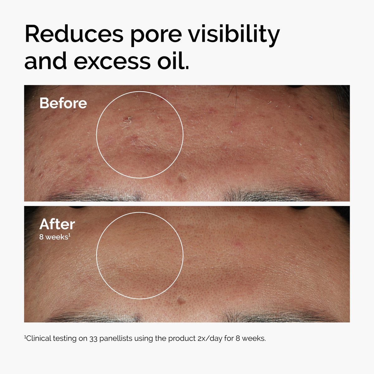 The Ordinary trio held in hand to show compact 1 fl oz size and portability