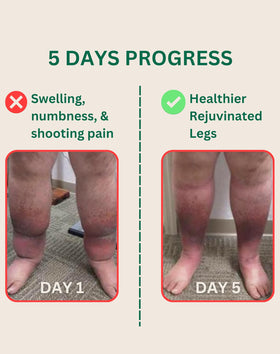 The Senzio balm beside compression socks, demonstrates complementary use for comfort