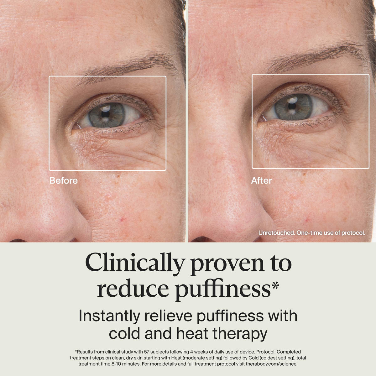 TheraFace wand used under eye reducing puffiness for refreshed look