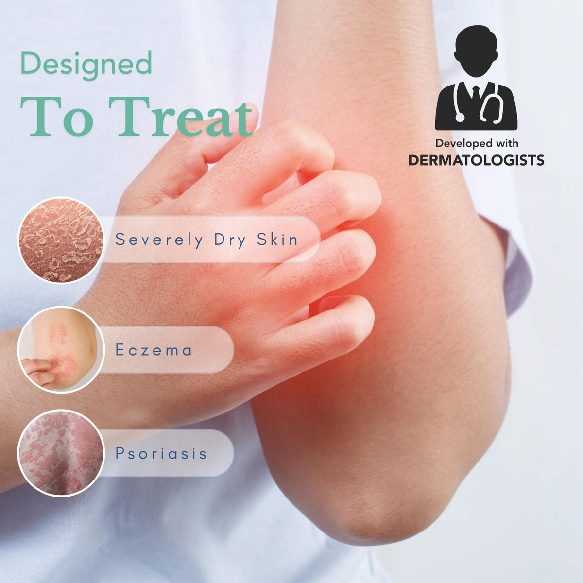 Theraplex open jar displaying thick cream texture and creamy consistency benefit