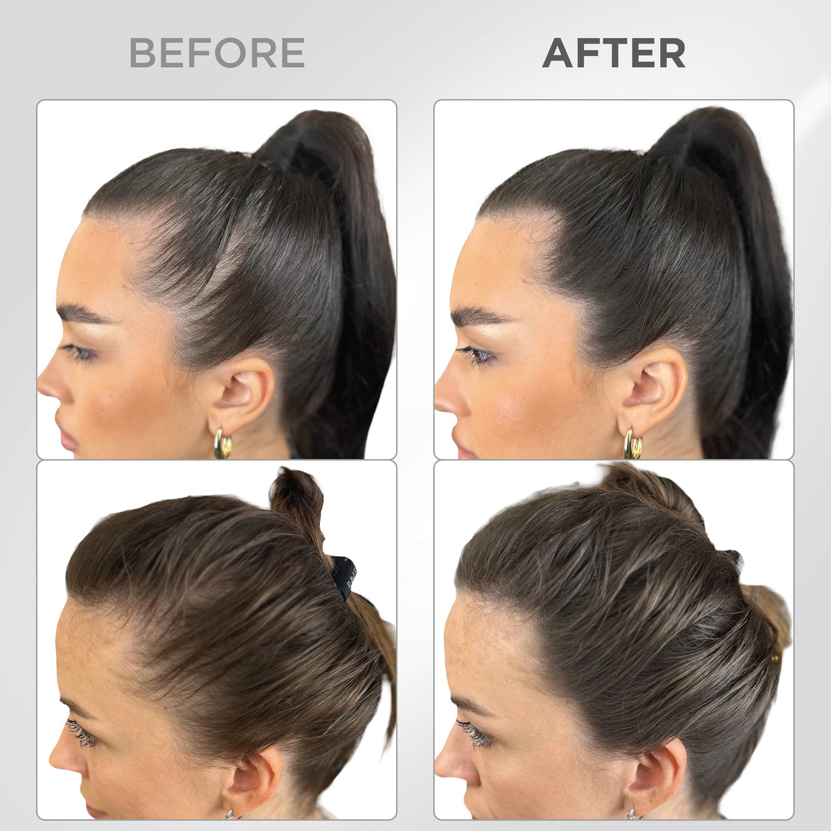 THICK FIBER before and after part application demonstrating fuller hairline