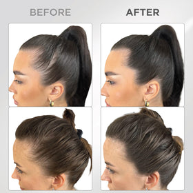 THICK FIBER before and after part application demonstrating fuller hairline