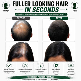 Thick Fiber used along hairline to hide receding edges and add density