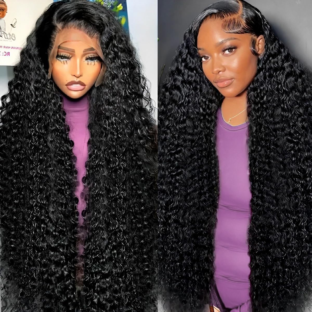 Tholap front view showing natural hairline benefit of realistic appearance