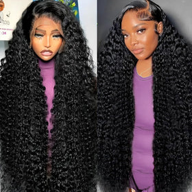 Tholap front view showing natural hairline benefit of realistic appearance
