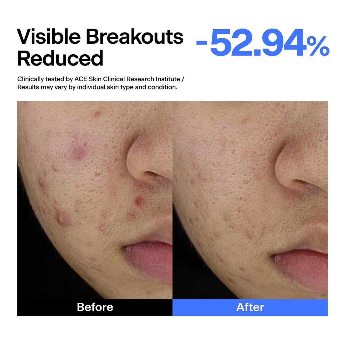 THOME ABC Serum applying to cheek with dropper, demonstrates targeted spot use