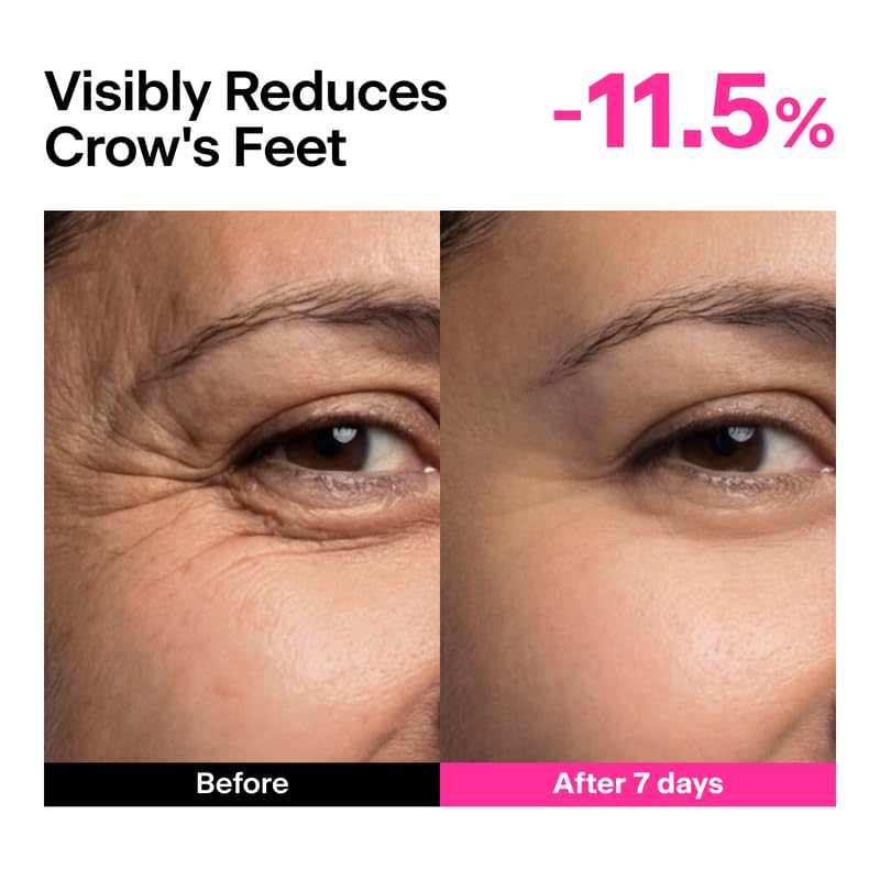 THOME before and after texture comparison, illustrates visible smoothing benefit
