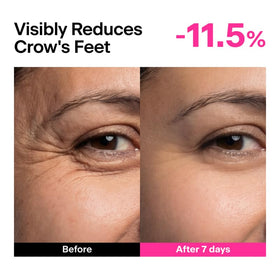 THOME before and after texture comparison, illustrates visible smoothing benefit
