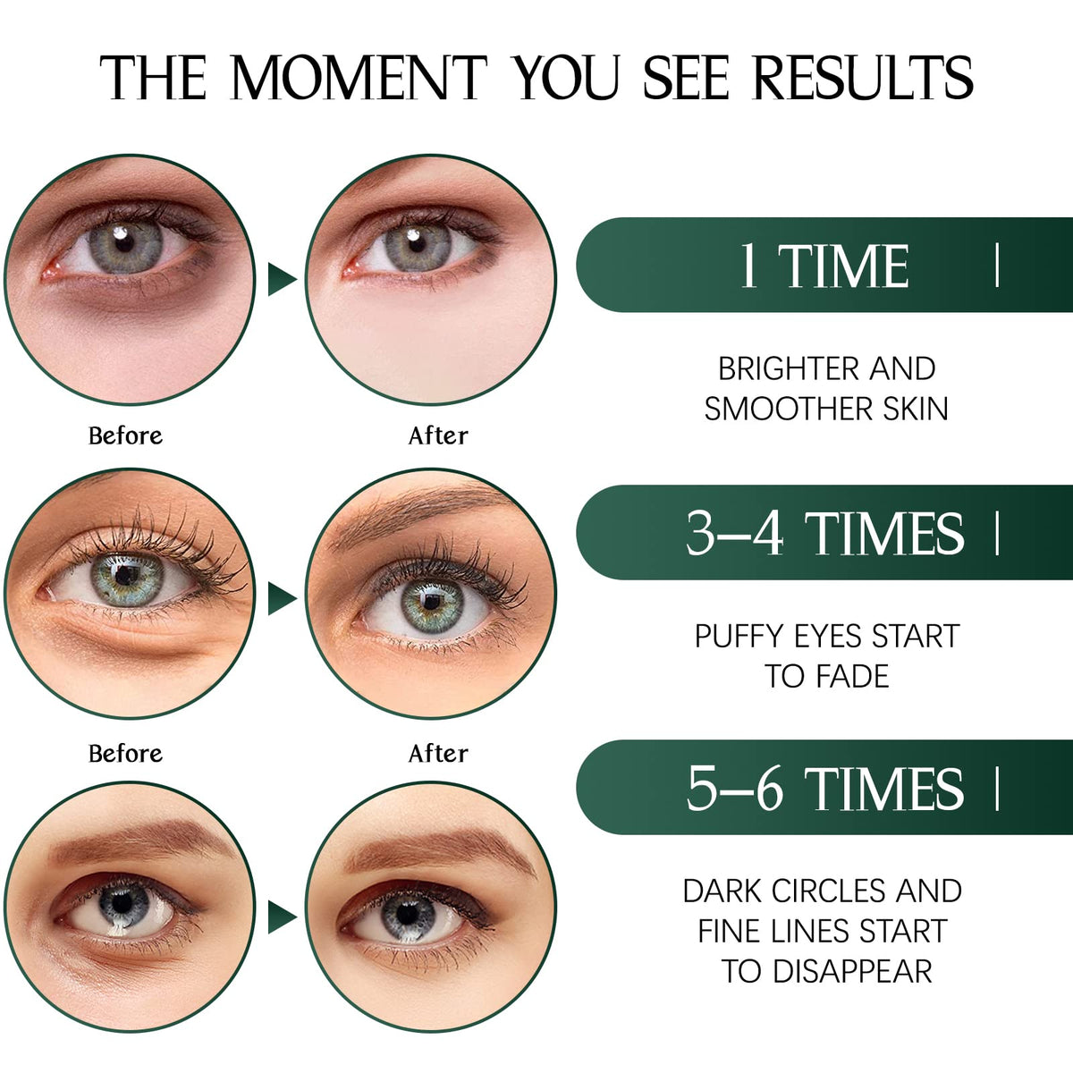 Tiepetly applied under eye in use demonstrating de-puffing and quick refresh