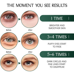 Tiepetly applied under eye in use demonstrating de-puffing and quick refresh