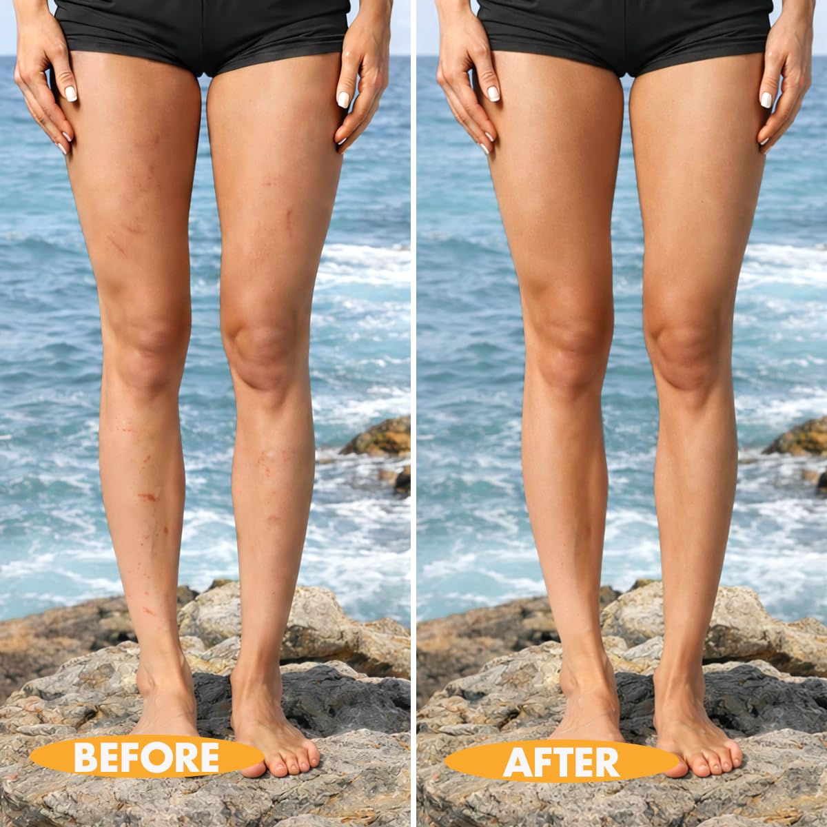 Timmi Beauty before and after leg coverage showing marked concealment