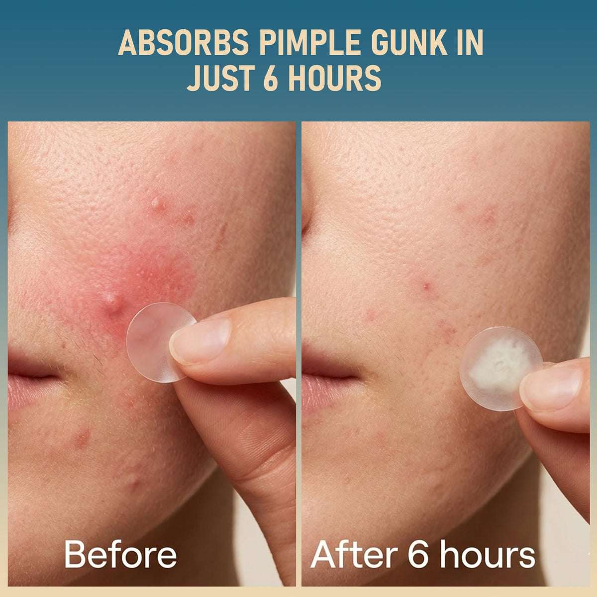 TKGOU patch applied to cheek demonstrating protection and discreet wear