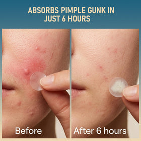 TKGOU patch applied to cheek demonstrating protection and discreet wear