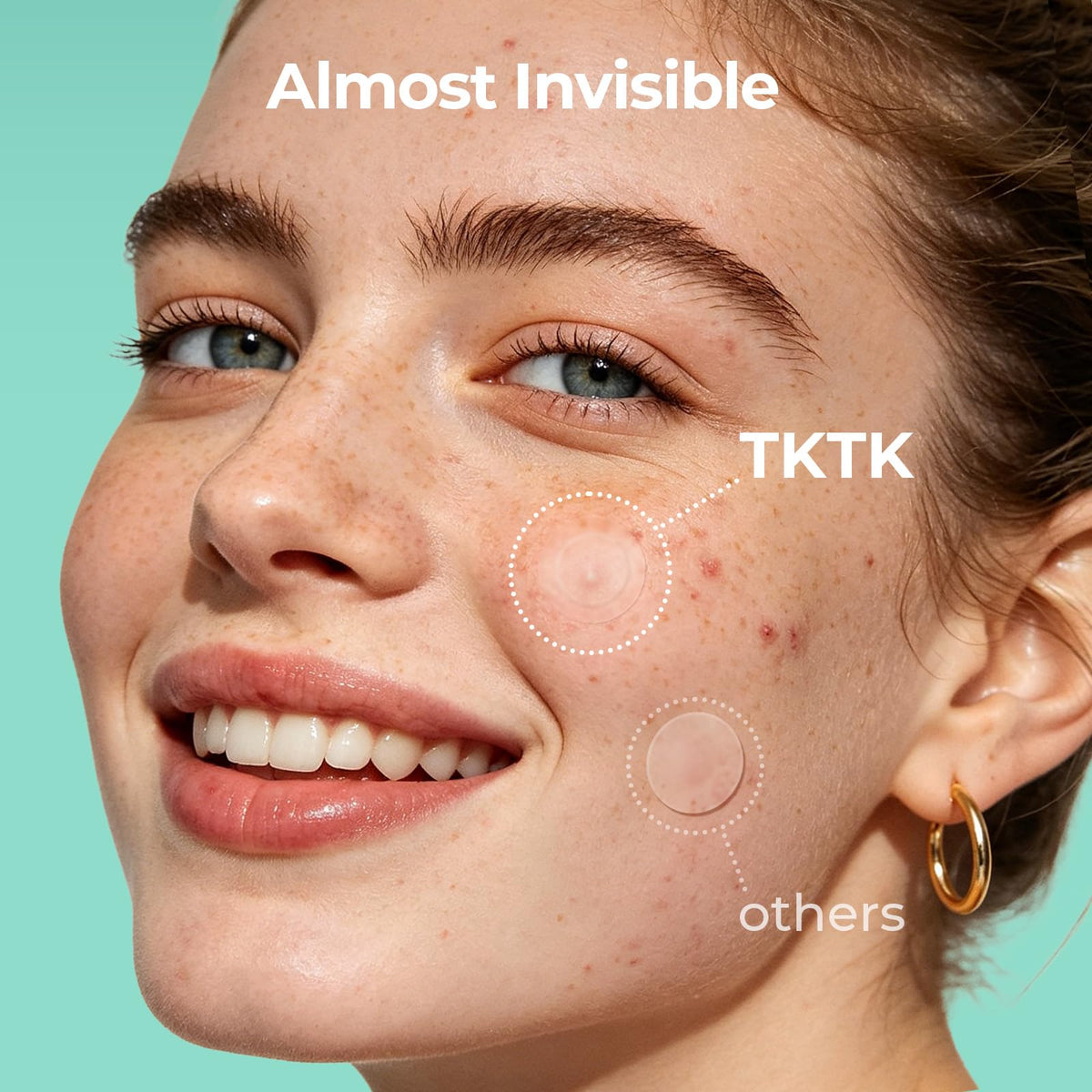 TKTK 10mm and 12mm patches shown side-by-side for size comparison benefit