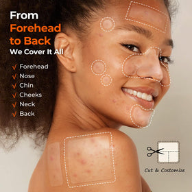 TKTK assorted patch sizes spread out to show six different shapes, targeted coverage