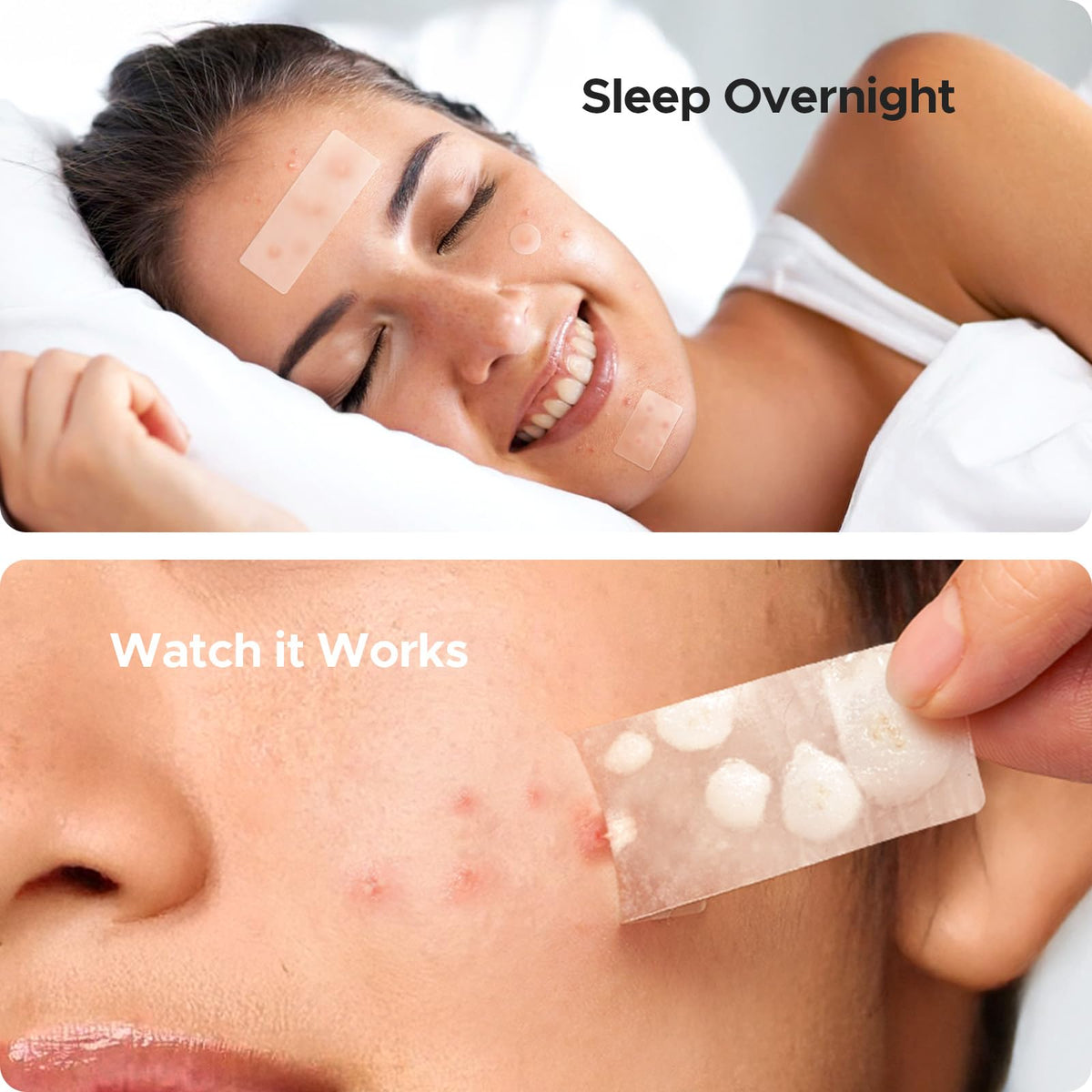 TKTK patches on chin and forehead demonstrating discreet daytime wear