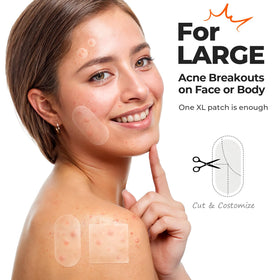 TKTK hydrocolloid texture detail showing thin breathable film for gentle protection