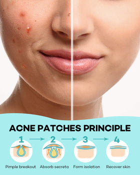 TKTK patch nearly invisible under light makeup for discreet blemish coverage