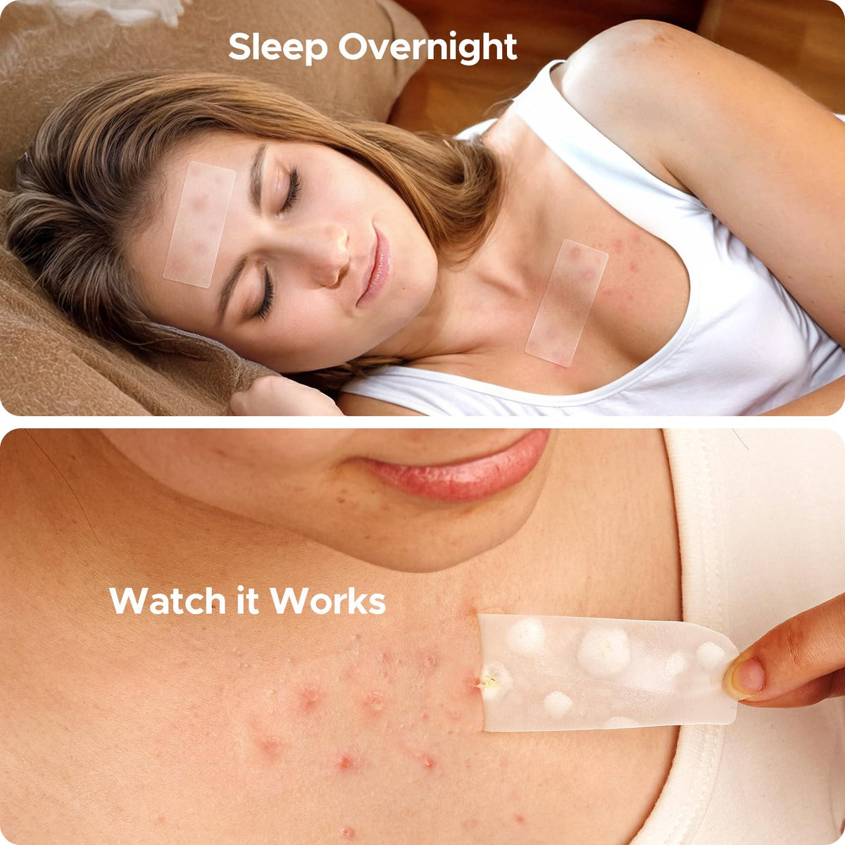TKTK patch on forehead protecting and concealing a blemish