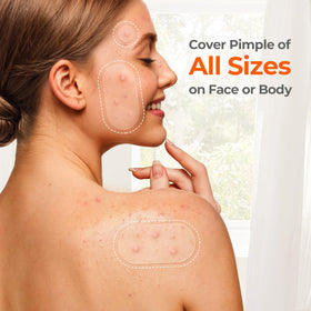 TKTK hydrocolloid texture close-up highlighting gunk-absorbing core