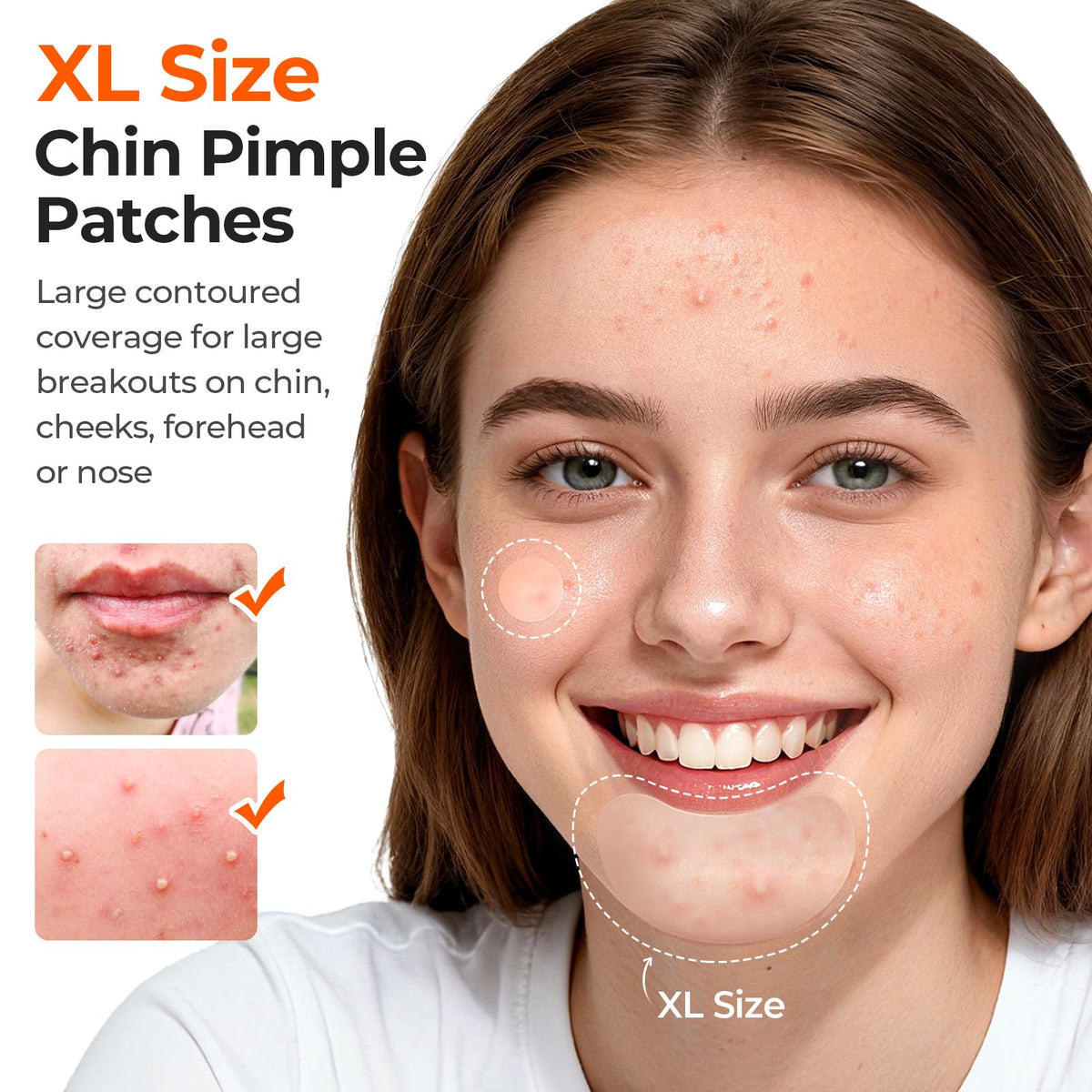 TKTK extra-large contoured patch close-up showing curved fit