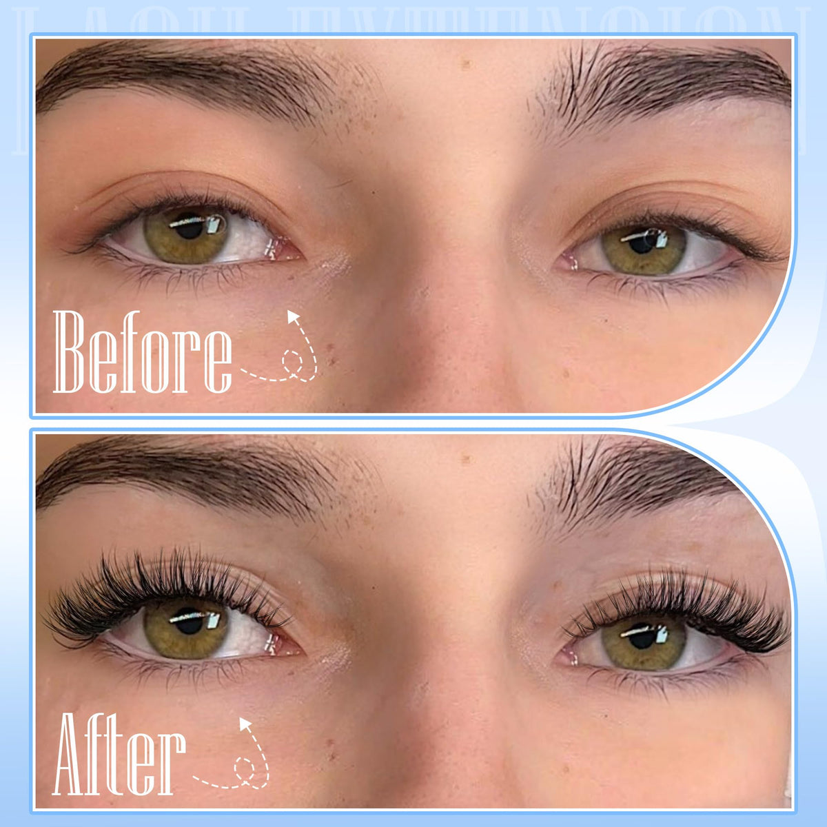 TNFVLONEINS tweezers and bonding adhesive displayed for precise placement benefit