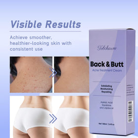 Tobcharm cream texture close-up illustrating lightweight absorbent formula