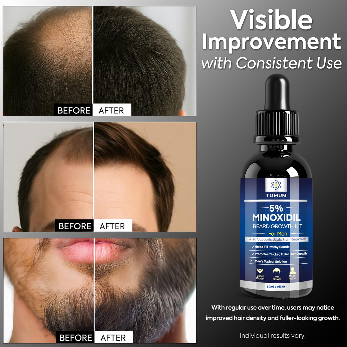 TOMUM applicator applying serum to beard for targeted coverage and control