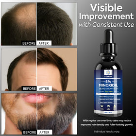 TOMUM applicator applying serum to beard for targeted coverage and control