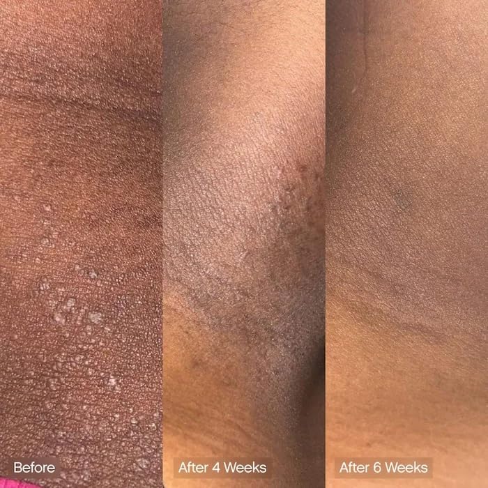 Topicals bar applied to arm showing even tone support
