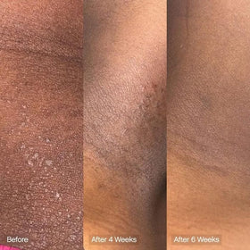 Topicals bar applied to arm showing even tone support