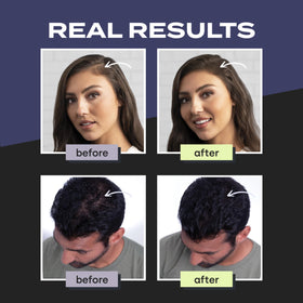 Toppik fibers being applied to the crown offering discreet coverage