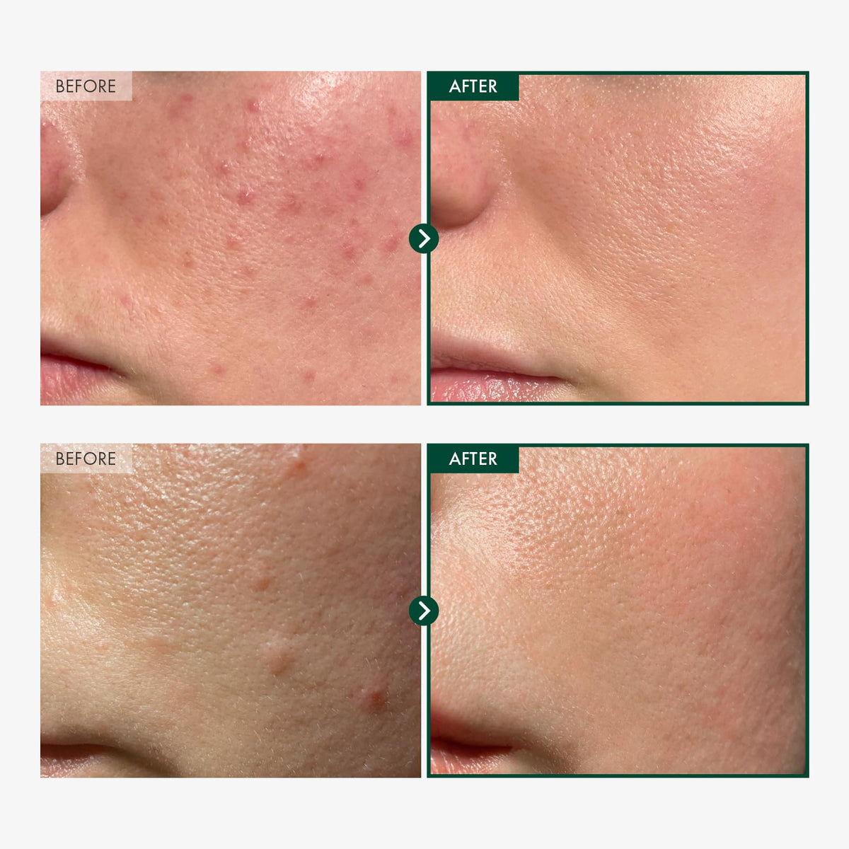 TOSOWOONG dropper close-up dispensing serum for precise application