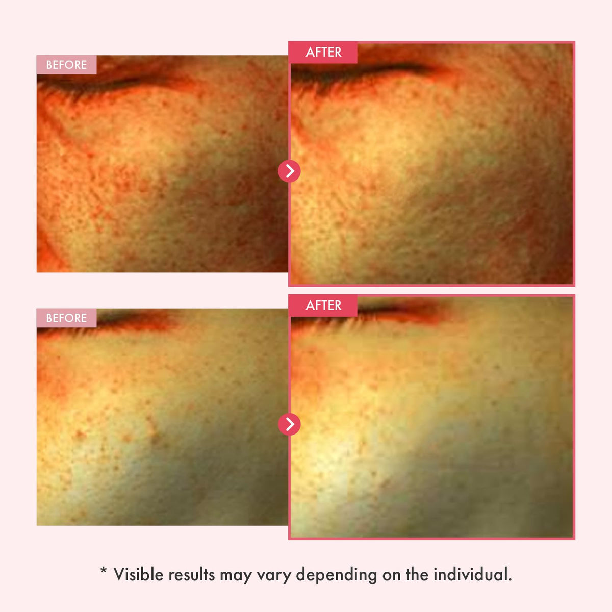 TOSOWOONG close-up of pink formula highlighting glow-boosting antioxidants