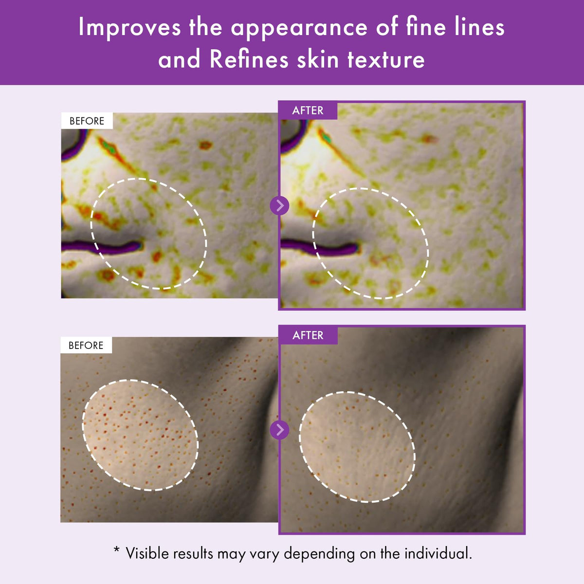 TOSOWOONG ingredient label close-up highlighting retinol and peptides