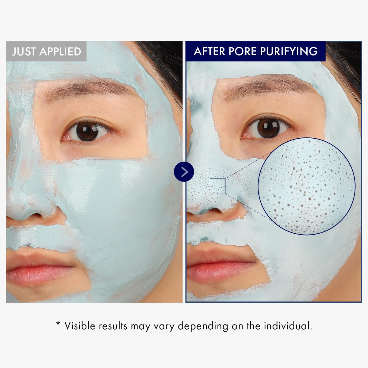 TOSOWOONG mask applied on face delivering cooling feel and deep cleanse