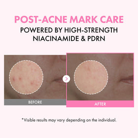 TOSOWOONG close-up of pink milky texture demonstrating rich hydration and smooth absorption