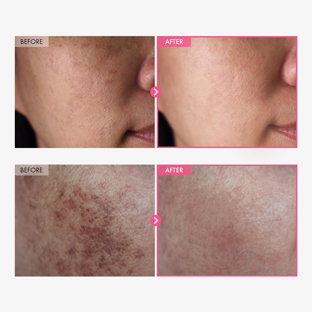 TOSOWOONG close-up cream texture highlighting fast-absorbing finish